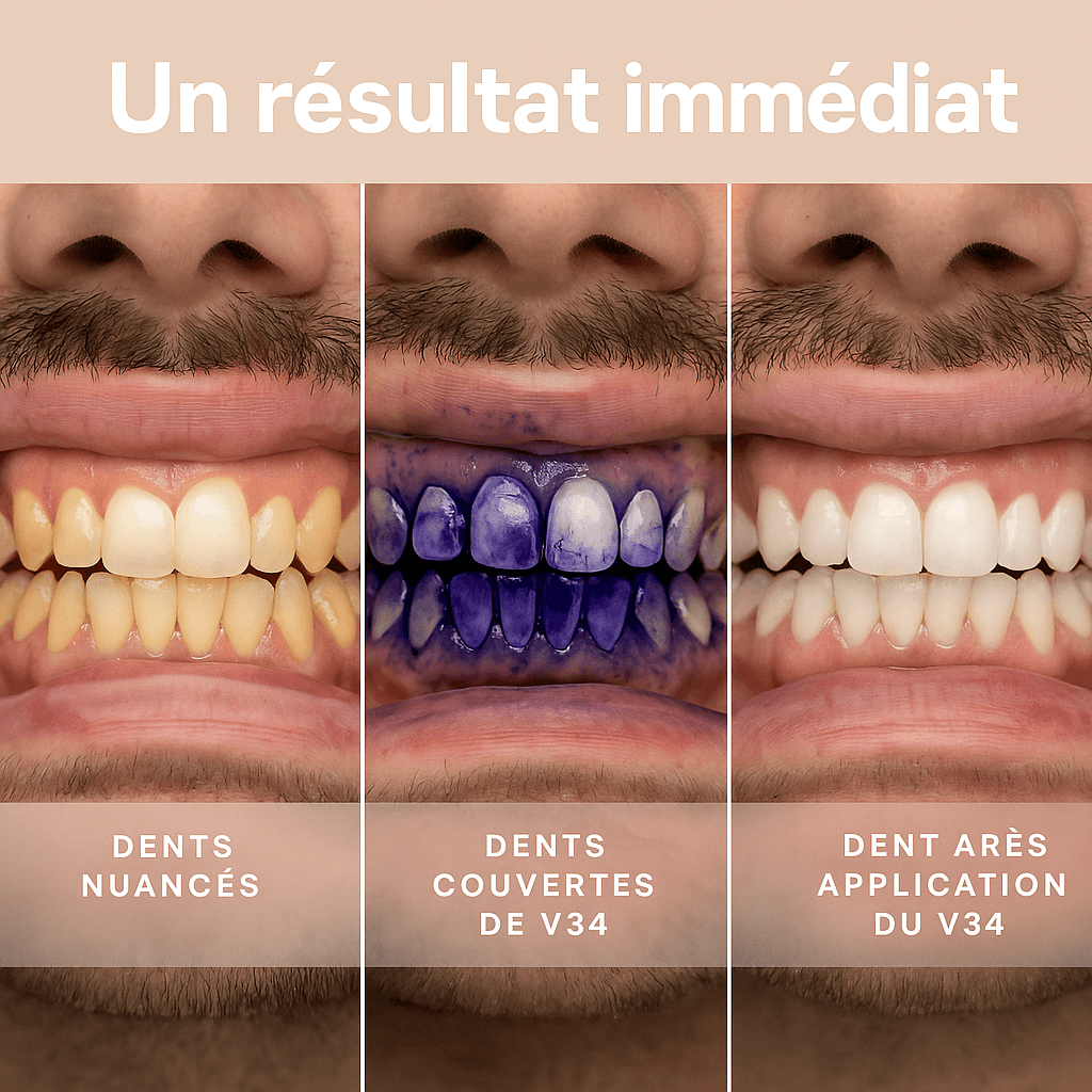Sérum blanchissant V34